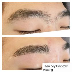 Glow Beauty Waxing - Teen unibrow