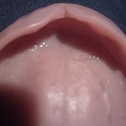 Affordable Dentures & Implants - So think it feels like a boxing mouth piece..