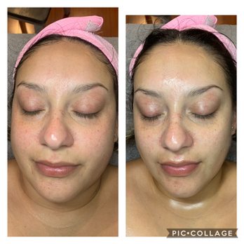 Pretty Little Rose Waxing Studio - Brightening Facial with Hydrojelly Mask - Waxing Near Me Pretty Little Rose Waxing Studio - Brightening Facial with Hydrojelly Mask - Waxing Near Me