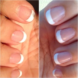 12 hrs after nail polish application: air bubbles, cracking, & peeling. 12 hrs after nail polish application: air bubbles, cracking, & peeling.