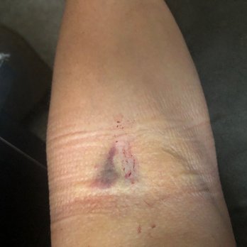 Biomat USA - Some incompetent fool named Justin When this guy failed to listen check for air in the bottle I knew this was going to happen - Blood & Plasma Donation Centers Near Me - Reading, Pennsylvania