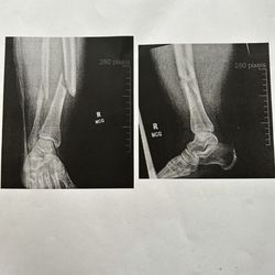 Summit Spine & Joint Centers