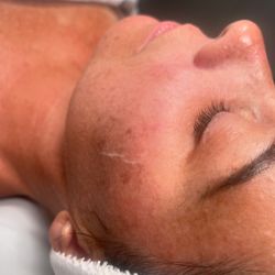 Ana Belen Skincare - Dermaplane