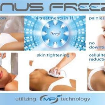 Tess Mauricio, MD - We were the first in Southern California to offer The Venus Freeze! - Dermatologists Near Me - San Diego, California Tess Mauricio, MD - We were the first in Southern California to offer The Venus Freeze! - Dermatologists Near Me - San Diego, California