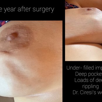 Athenix | Advanced Plastic Surgery & Aesthetic Centers | Fresno - Cosmetic Surgeons Near Me - Fresno, California Athenix | Advanced Plastic Surgery & Aesthetic Centers | Fresno - Cosmetic Surgeons Near Me - Fresno, California