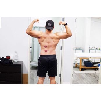 Hybrid Wellness Acupuncture - Satisfied customer - Acupuncture Near Me - Glendale, California Hybrid Wellness Acupuncture - Satisfied customer - Acupuncture Near Me - Glendale, California
