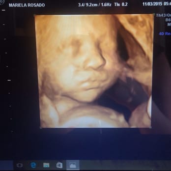 Beautiful Beginnings 3D Imaging - Look at her chubby little tummy - Diagnostic Imaging Near Me - Scarsdale, New York Beautiful Beginnings 3D Imaging - Look at her chubby little tummy - Diagnostic Imaging Near Me - Scarsdale, New York
