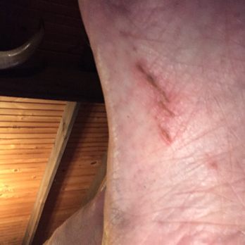 Number 1 Nails - Recently got a pedicure and the technician scrubbed my foot so hard it left a scar on my arch!  I'm diabetic so it will take time to heal! - Nail Salons Near Me - Vine Grove, Kentucky