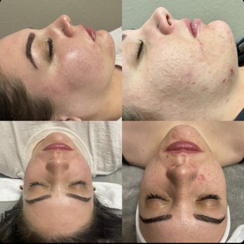 The Lash And Body Bar - Left side is recently and right side is a year ago when we first started! - Skin Care Near Me - Las Vegas, Nevada The Lash And Body Bar - Left side is recently and right side is a year ago when we first started! - Skin Care Near Me - Las Vegas, Nevada