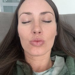 Kalos Facial Plastic Surgery - After - Restored my beauty
