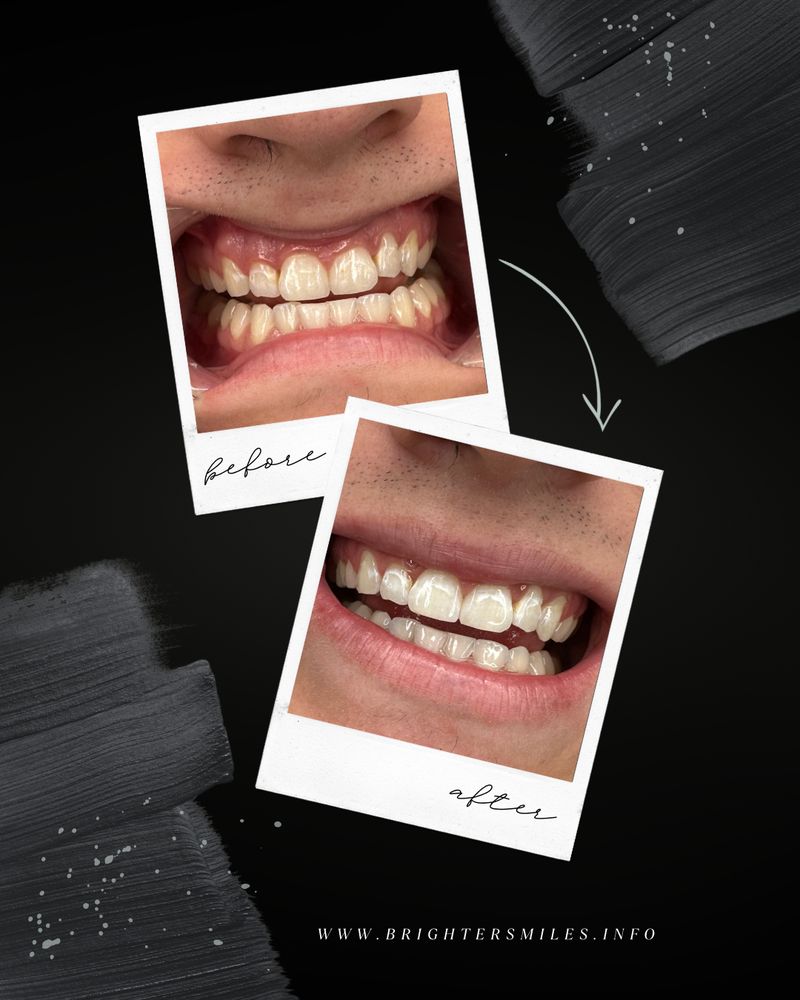 Brighter Smiles and Beauty Logo