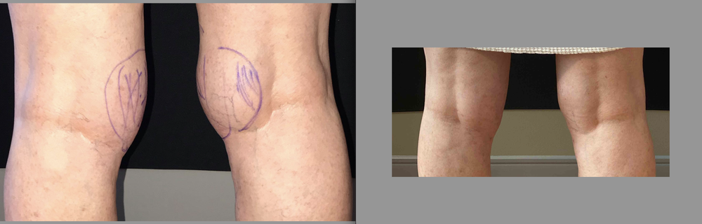 Mountcastle Plastic Surgery and Vein Institute