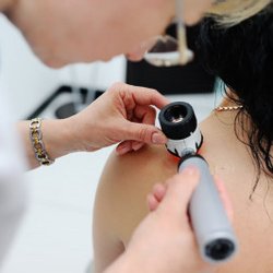 Benson Dermatology