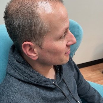 Mind & Body Rejuvenation Clinic - Picture taken by Danielle at her facility. - Hair Loss Centers Near Me - Temecula, California