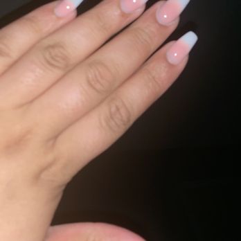 Rainbow Falls Dental - Acrylic nails - General Dentistry Near Me - Chestermere, Alberta