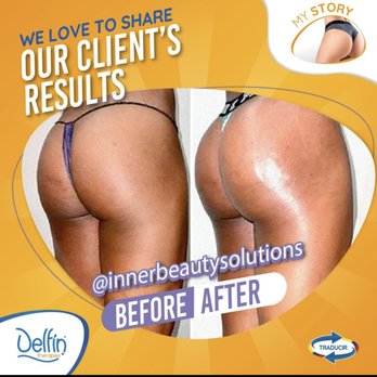 Dy Beauty Studio - Estheticians Near Me Dy Beauty Studio - Estheticians Near Me