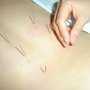 Photo of Kyoung Cho Acupuncture Clinic
