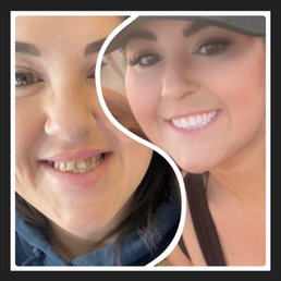 New smile Courtesy of Sunny Badyal! I have never smiled so much in my life! New smile Courtesy of Sunny Badyal! I have never smiled so much in my life!