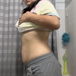 Medi-Slim Wellness - AFTER photo @166 lbs