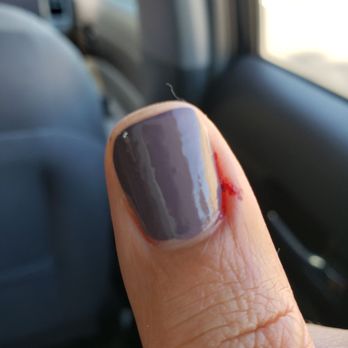 Chill N8ils studio  - My mangled, painful thumb. - Nail Salons Near Me - Vallejo, California