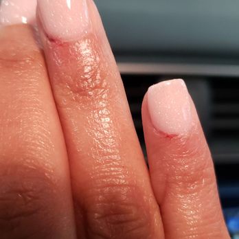 Amity Nail Spa - Just out of the salon - you can see the blood and the cuts - Nail Salons Near Me - Arlington, Virginia Amity Nail Spa - Just out of the salon - you can see the blood and the cuts - Nail Salons Near Me - Arlington, Virginia