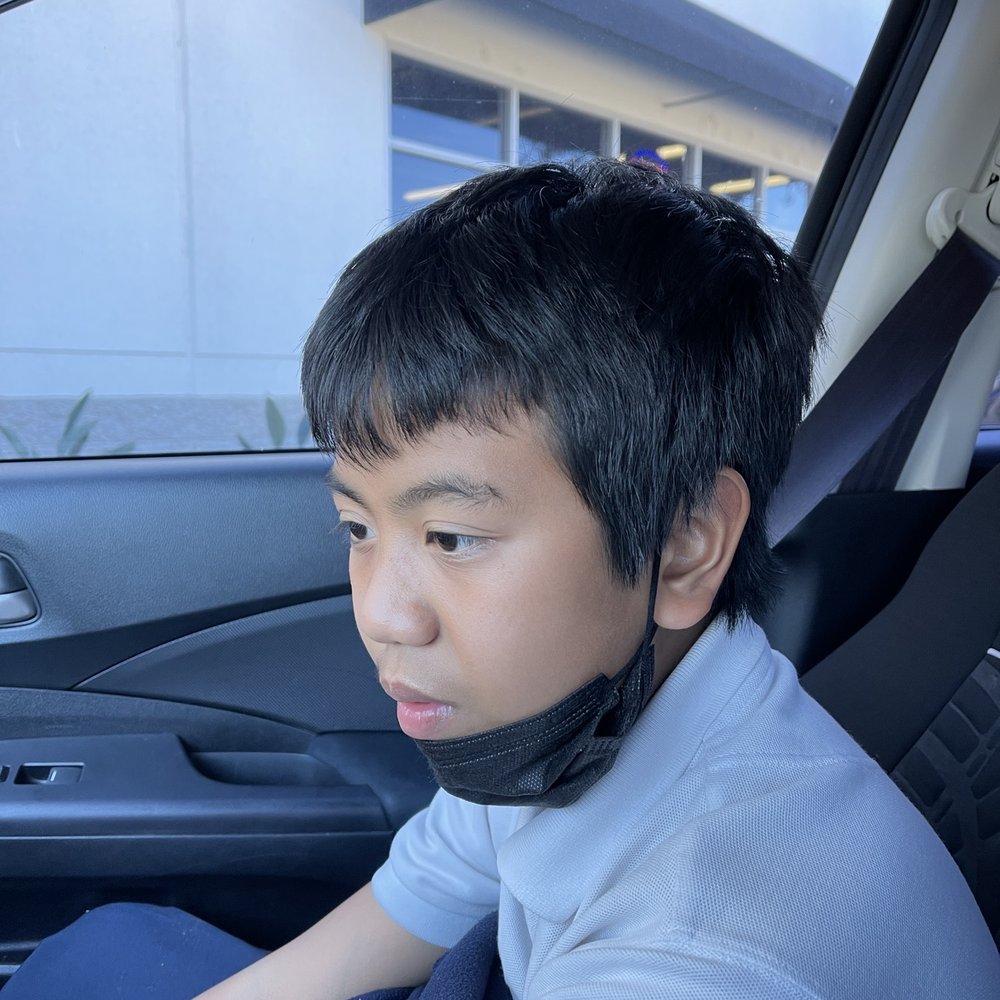 Before Before