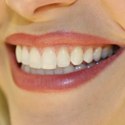 Lake Dental - "The Northland's Leader in Cosmetic Dentistry and Exceptional General Dental Care"