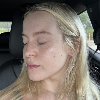 Alchemy Skin - Acne Treatment Near Me - Plano, Texas Alchemy Skin - Acne Treatment Near Me - Plano, Texas