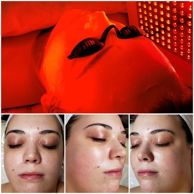 CRYSTAL PURE SKIN CARE - 465 Photos - 592 Ridge Rd, North Arlington