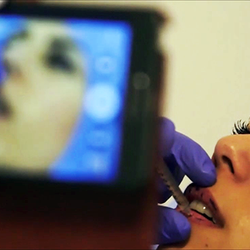 Dr. Selcuk Guney - Face fillers and botox in 1 hour