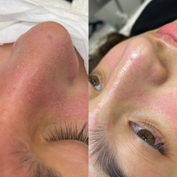 HL Med Spa - FACIALS - Medical Spas Near Me - Newark, New Jersey HL Med Spa - FACIALS - Medical Spas Near Me - Newark, New Jersey