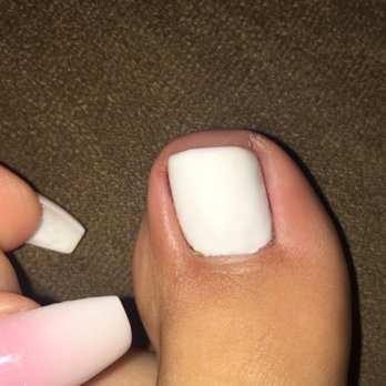 Wonder Nails - Dried ring of blood on left side of toe, swollen and tender to the touch - Nail Salons Near Me - Seattle, Washington Wonder Nails - Dried ring of blood on left side of toe, swollen and tender to the touch - Nail Salons Near Me - Seattle, Washington