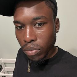 Estheglow Spa - Results from my facial treatment!