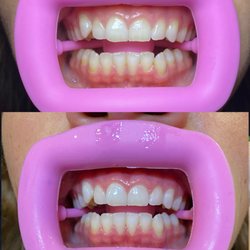 Before and after