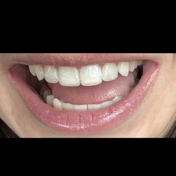 Jack Ringer, DDS - Cosmetic Dentists Near Me - Anaheim Hills, California