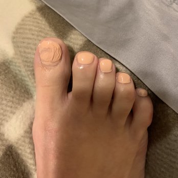 Star Nails & Spa - Ruined pedicure - Nail Salons Near Me - Hingham, Massachusetts