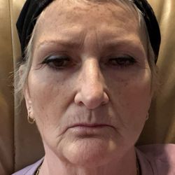 Skin Deep Rejuvenation Center - Before I started.