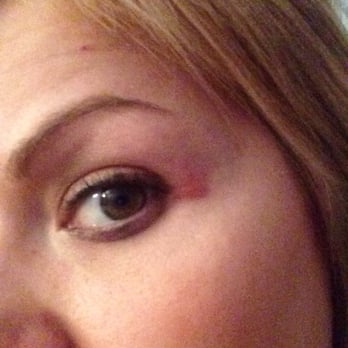 Salon 18 - My red swollen eye from my vigorous hair washing that lead to be being stabbed in the eye with a soapy finger nail. - Hair Salons Near Me - Scottsdale, Arizona Salon 18 - My red swollen eye from my vigorous hair washing that lead to be being stabbed in the eye with a soapy finger nail. - Hair Salons Near Me - Scottsdale, Arizona