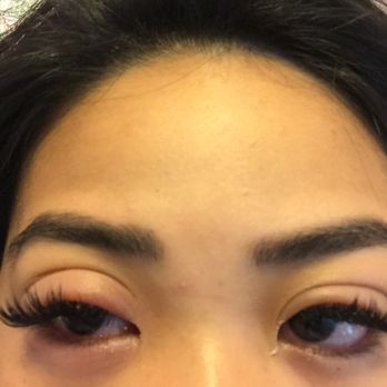 Gallery-The Spa - my swollen eye a day after my 5D volume extensions - Skin Care Near Me - New Westminster, British Columbia