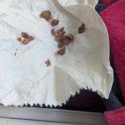 San Francisco Health Care and Rehab - Stuff scraped from under curled nails