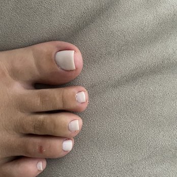 Olympic Nails - This is what my stumps looked like after they "fixed" it - Nail Salons Near Me - Los Angeles , California
