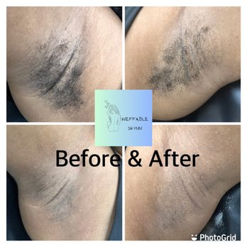 Ineffable Skynn - Underarm Wax - Waxing Near Me - Milwaukee, Wisconsin Ineffable Skynn - Underarm Wax - Waxing Near Me - Milwaukee, Wisconsin