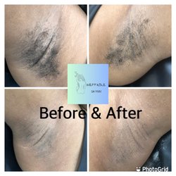 Ineffable Skynn - Underarm Wax