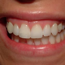 Family Dentistry - After!