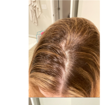 CKC Salon & Keratin Bar - CKC thick/unnatural brassy Foiled highlights to cover incorrectly done Balayage - Hair Salons Near Me - Darien, Connecticut