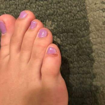 T T Nails - Left with dried blood on my toes. - Nail Salons Near Me - Saratoga Springs, New York T T Nails - Left with dried blood on my toes. - Nail Salons Near Me - Saratoga Springs, New York