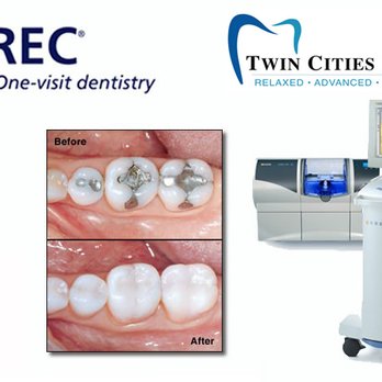 Twin Cities Dental - Cosmetic Dentists Near Me - Andover, Minnesota Twin Cities Dental - Cosmetic Dentists Near Me - Andover, Minnesota