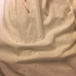 ~Blood that we found on our sheets. We talked to the Gen Mgr Barb who gave us a room credit however, we would have preferred CLEAN sheets!
