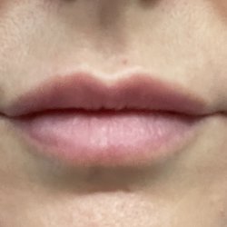 The Face Place - One week after