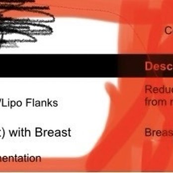 Dallas Plastic Surgery Institute - Original surgical plan discussed and agreed on by Dr. Burns. - Plastic Surgeons Near Me - Dallas, Texas Dallas Plastic Surgery Institute - Original surgical plan discussed and agreed on by Dr. Burns. - Plastic Surgeons Near Me - Dallas, Texas